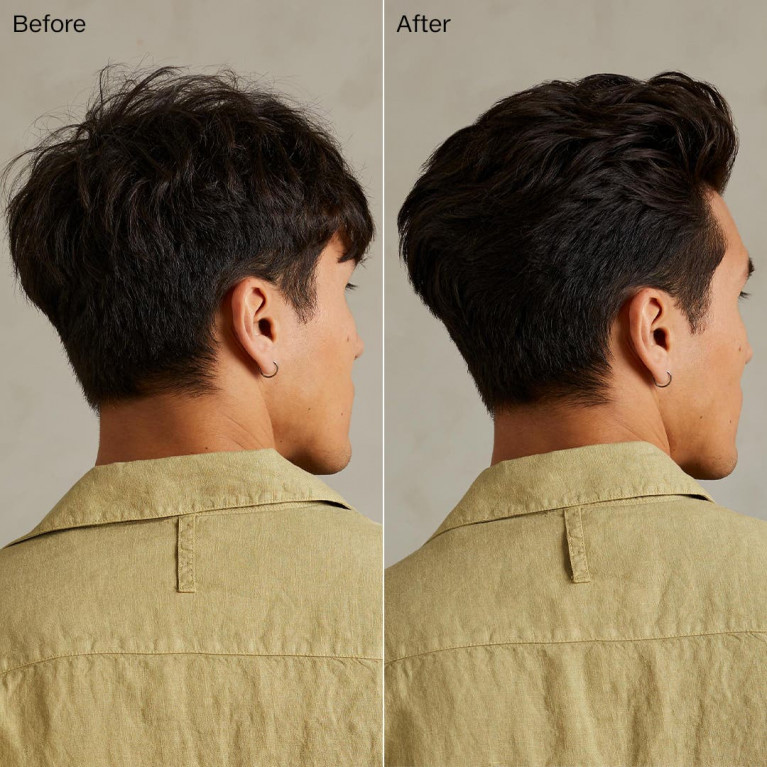 TEA TREE SPECIAL SHAMPOO