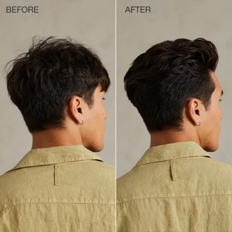 TEA TREE SPECIAL HAIR AND SCALP TREATMENT