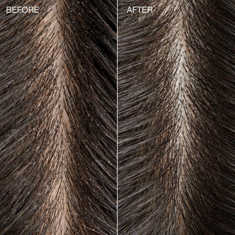 TEA TREE SPECIAL  DETOX KOMBUCHA RINSE